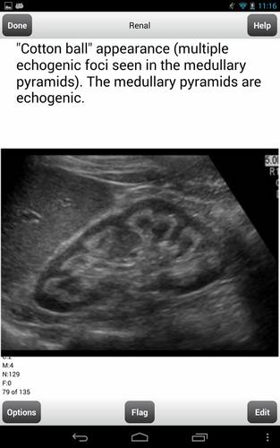 Ultrasound Flashcards Boards F