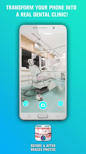 Before and After braces Photo